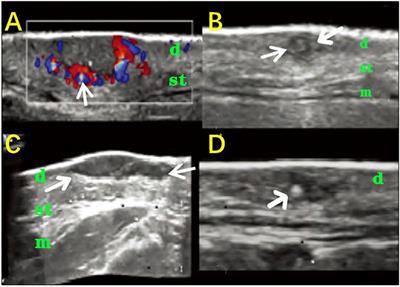 Emerging High-Frequency Ultrasound Imaging in Medical Cosmetology